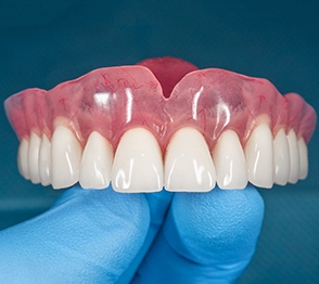 A closeup of a removable denture held in a gloved hand